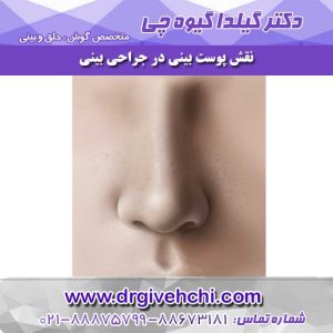 نقش پوست بینی در جراحی بینی