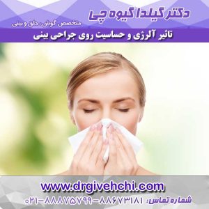 آلرژی در جراحی بینی