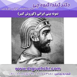 بینی ایرانی