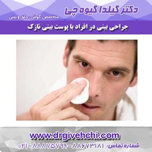 جراحی بینی در افراد با پوست بینی نازک