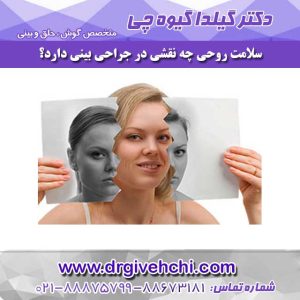 سلامت روحی در جراحی بینی