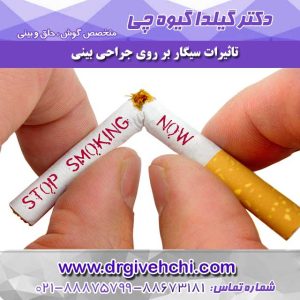 تاثیرات سیگار بر روی جراحی بینی
